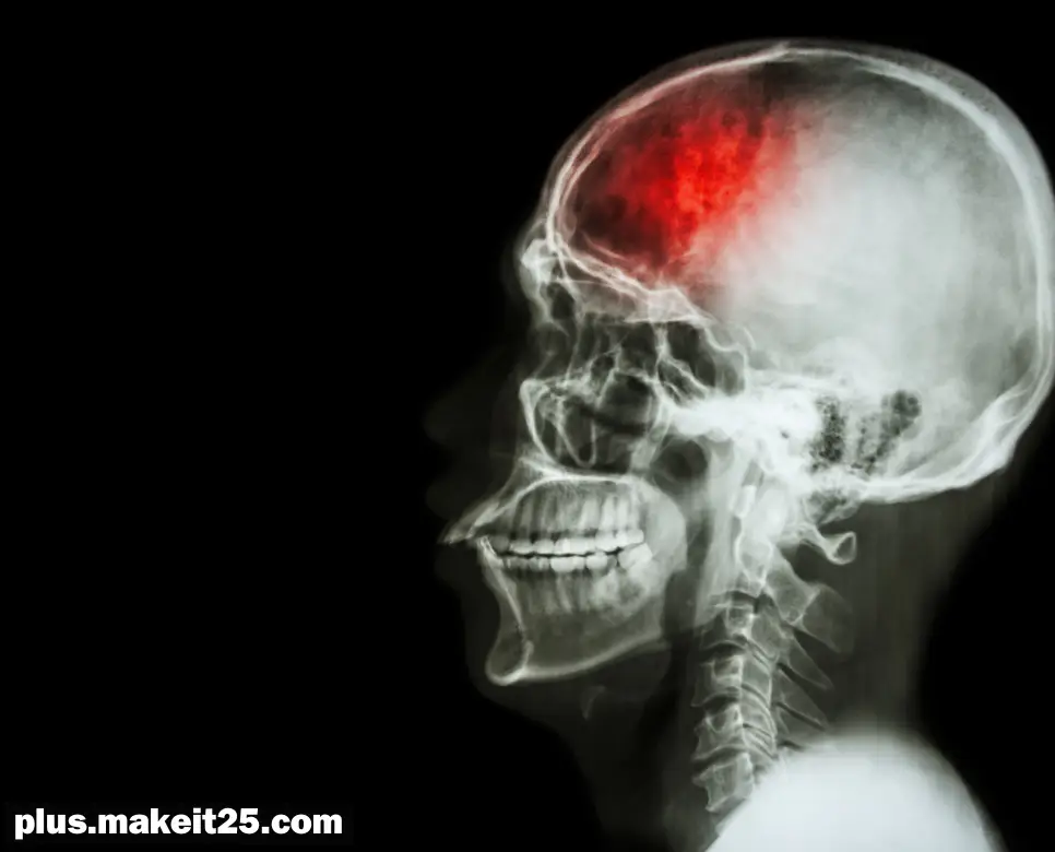 뇌졸중 초기증상