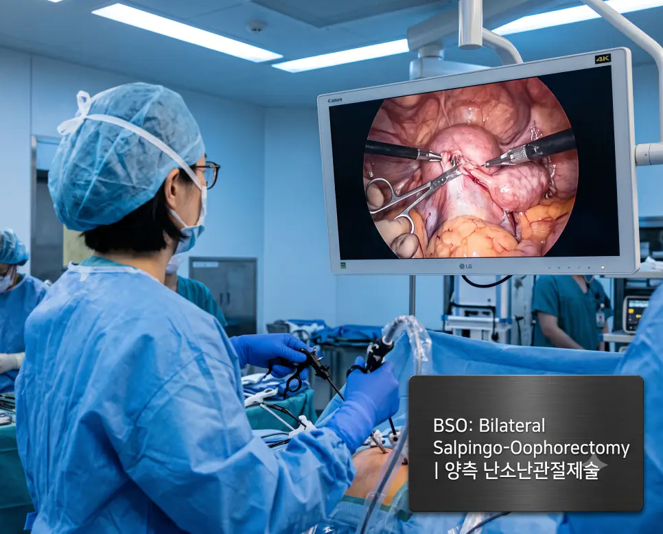 부인과 복강경 수술실에서 외과의가 모니터를 통해 양측 난소와 난관 절제 부위를 확인하며 정밀 집도하는 현장과 하단에 "BSO: Bilateral Salpingo-Oophorectomy | 양측 난소난관절제술" 타이포그래피만 조화롭게 들어간 수술실 이미지